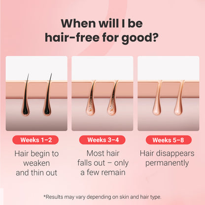 IPL fotoepiliatorius