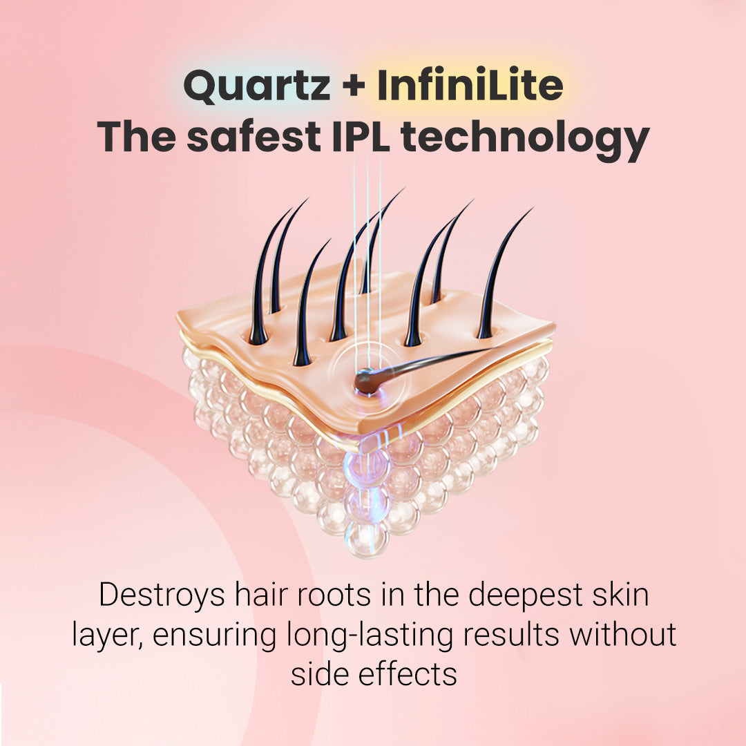 IPL fotoepiliatorius