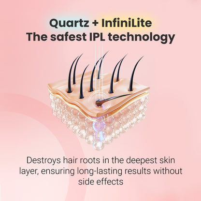 IPL fotoepiliatorius